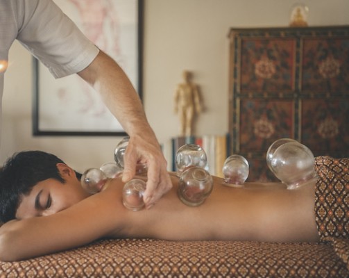Retreat in Thailand: Das traditionelle Therapieverfahren des Schröpfens ist eine von vielen Anwendungen, die das neue Wellnessprogramm für Frauen „Radiant Bliss“ umfasst. © Kamalaya Koh Samui